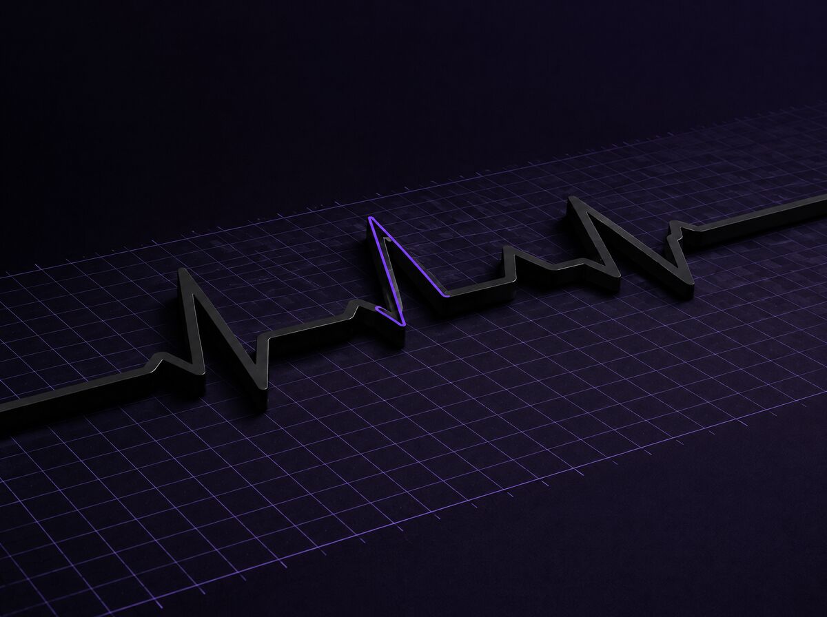 A raised black heartbeat waveform lying on a lavender grid like medical chart paper; one peak is traced in violet.
